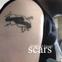 Childhood Friends : Scars