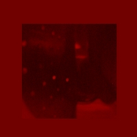 ETERMORTIFERA: Rojo Esperanza