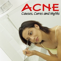 Acne Prevention Society : Acne - Causes, Cures, and Myths